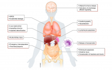 Summary of sepsis pathophysiology, Figure 1 from EMBO Mol Med 2020:e10128